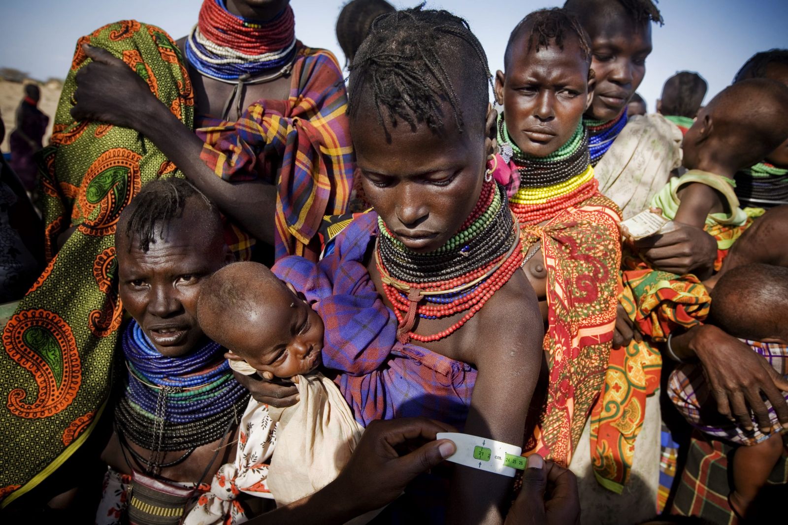 Проблемы восточной африки. Голод в Восточной Африке. Голодающие африканские дети.